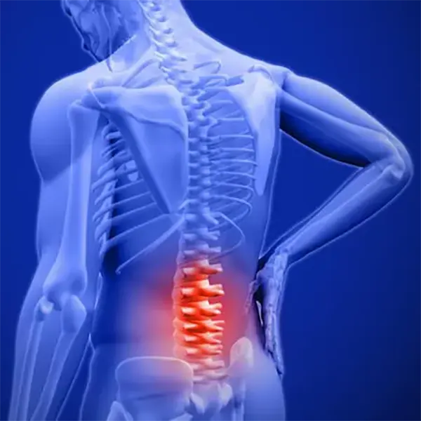 NonSurgical Spinal Decompression Therapy Near Me in Chicopee, MA.